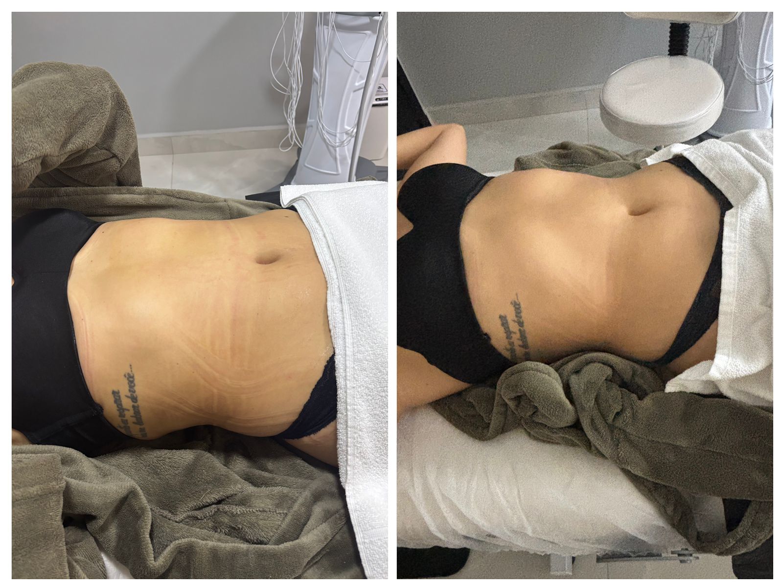 Drenagem Modeladora em São Bernardo do Campo
